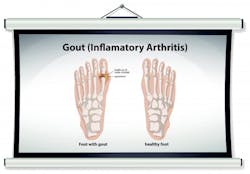 Fleetowner Com Sites Fleetowner com Files Uploads 2017 01 18 Gout2 Fleetowner Com Sites Fleetowner com Files Uploads 2017 01 18 Gout2