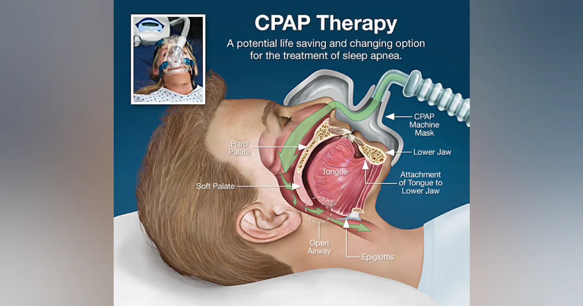Fix Cpap Machine How to fix common CPAP problems | FleetOwner