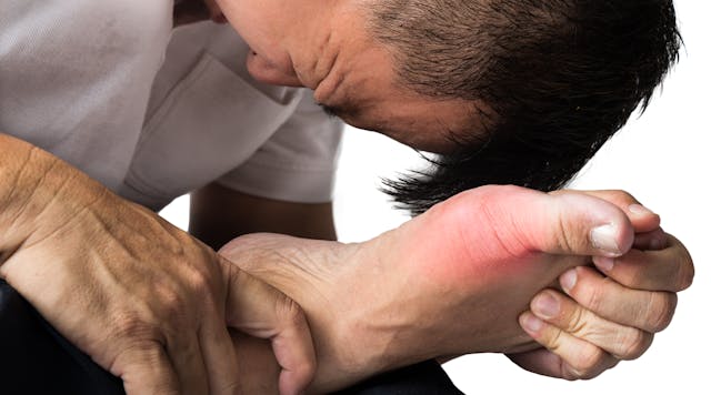 If a truck driver is getting more than one or two attacks of gout within a year, they ought to consider using medication. (Photo: Thinkstock)