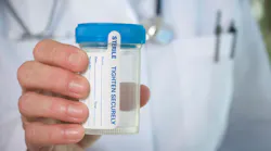 Drug test