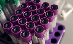 Drug Testing Stock Photo 5e34342a521ed Drug Testing Stock Photo 5e34342a521ed