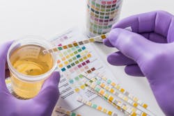 A top priority for many in the industry is moving the needle on hair testing for drugs and alcohol. A top priority for many in the industry is moving the needle on hair testing for drugs and alcohol.