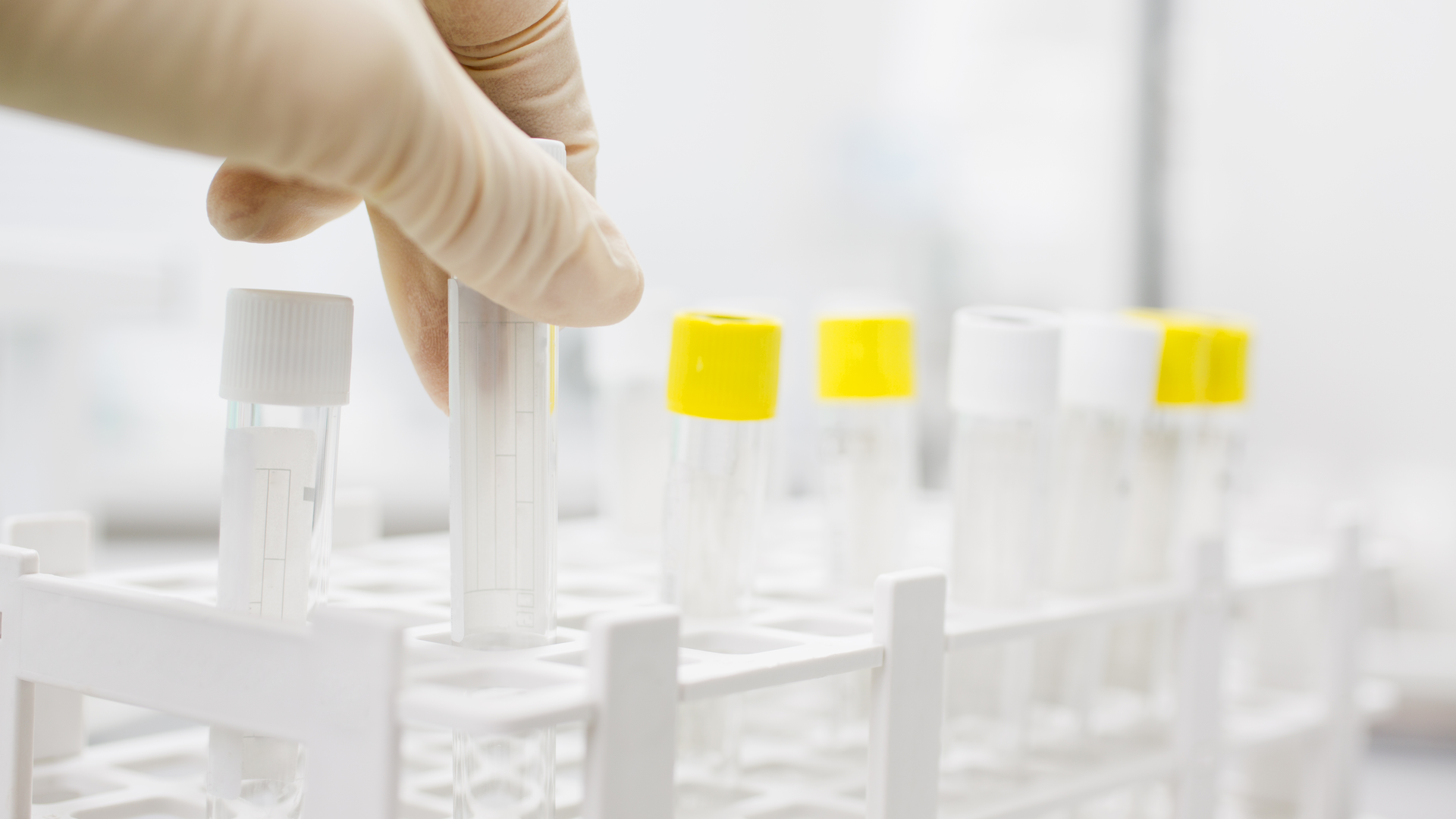 Drug Testing Flydragonfly Dreamstime 5fa5936f42bd0