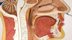 The AlaxoStent slides down the nasal passage and rests in the pharynx to prevent collapse of the airway and facilitate better breathing during sleep. The AlaxoStent slides down the nasal passage and rests in the pharynx to prevent collapse of the airway and facilitate better breathing during sleep.